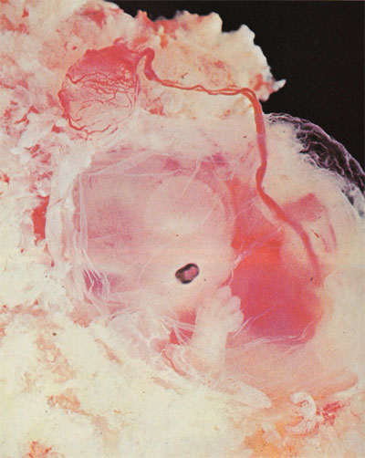 a 6½-week-old human embryo