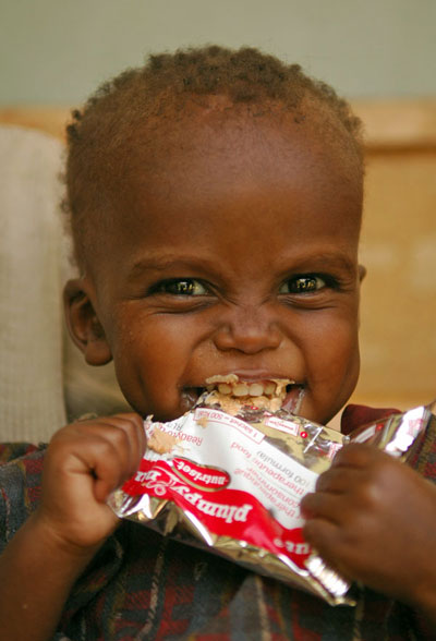 ethiopian boy eating plumpynut
